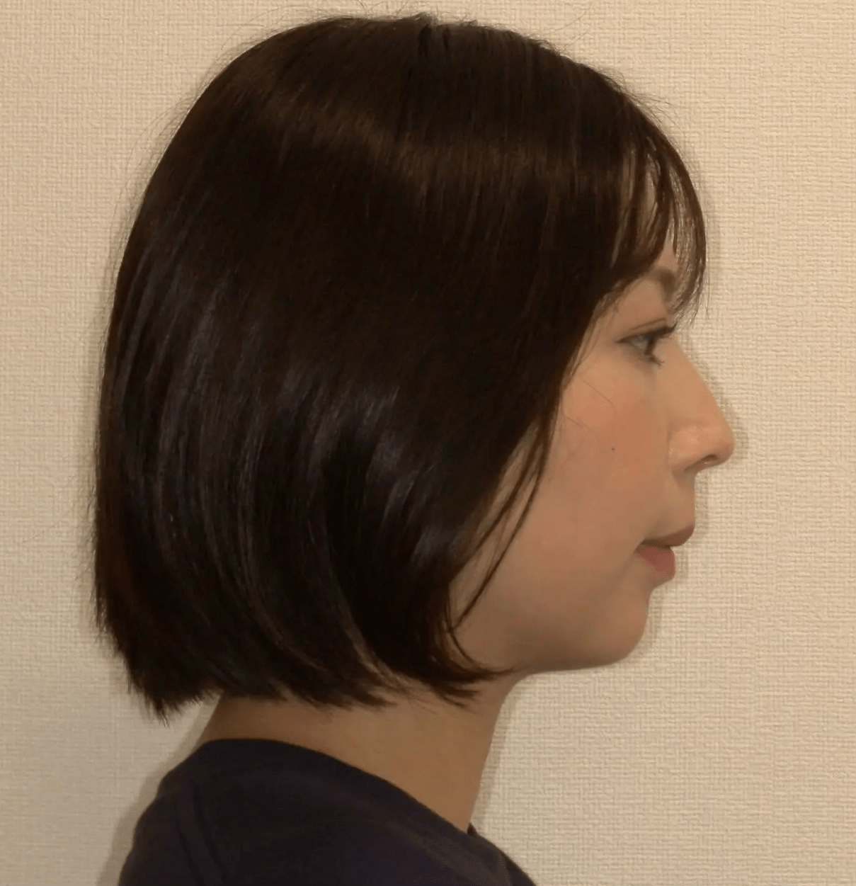 GS Before