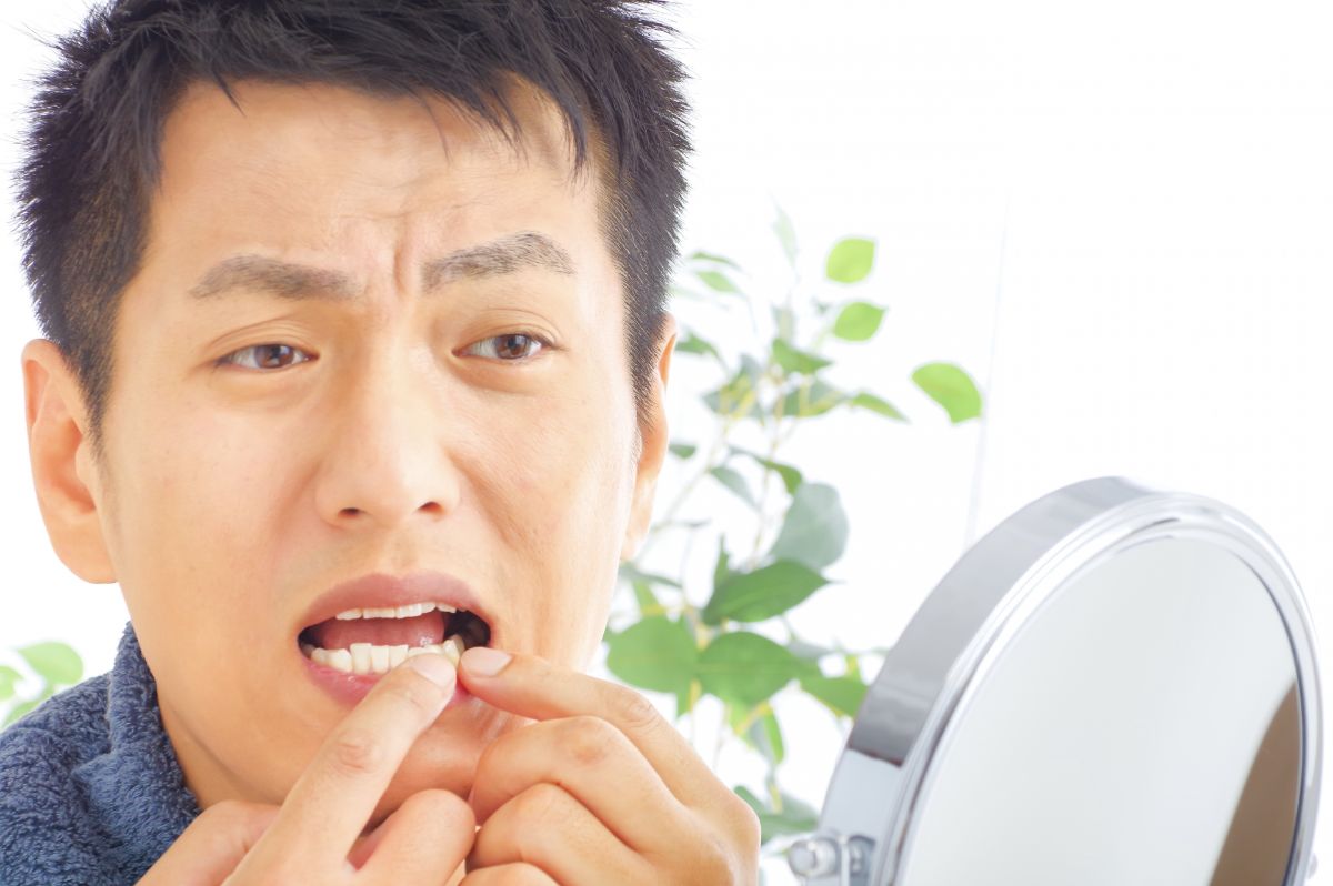 インビザライン矯正：歯並びの症例と治療方法を紹介