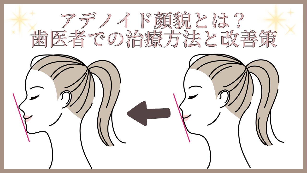 アデノイド顔貌とは？歯医者での治療方法と改善策を徹底解説